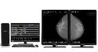 Mammography Diagnostic Workstation