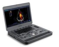 Portable Ultrasound